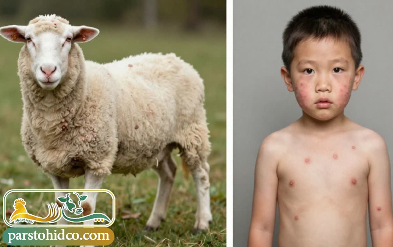 تفاوت‌ های کلیدی بین آبله گوسفندی و آبله انسانی 